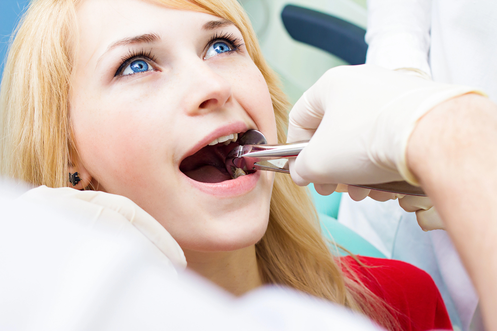 Extracao do dente siso