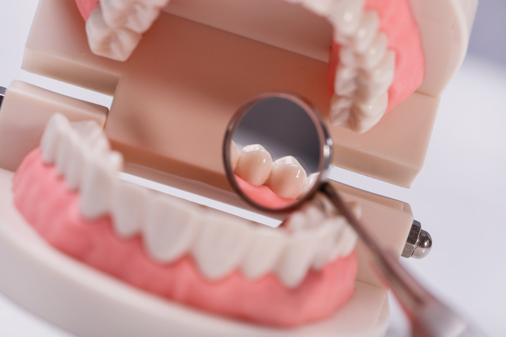 Quais são os benefícios da prótese dentária? 4 protese dentaria